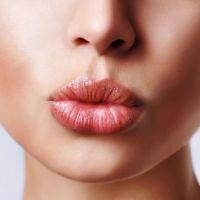 Увеличение губ гиалуроновой кислотой, описание процедуры коррекции внешности